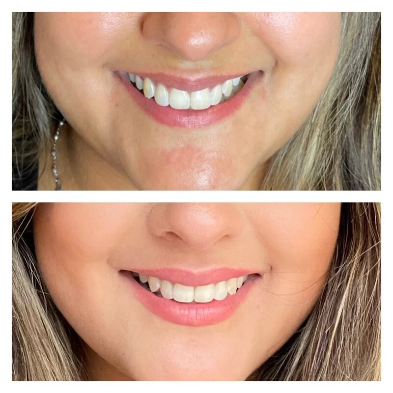 patient result 0