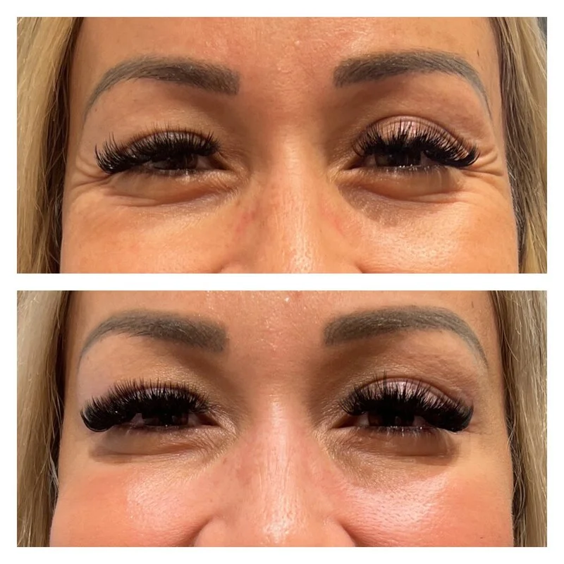patient result 9