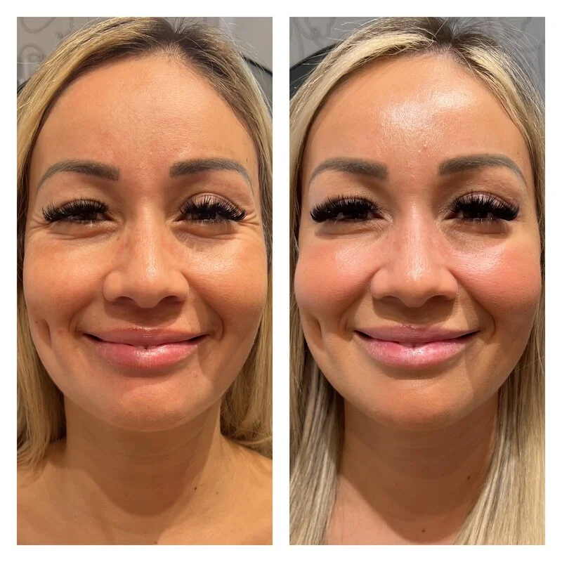 patient result 10