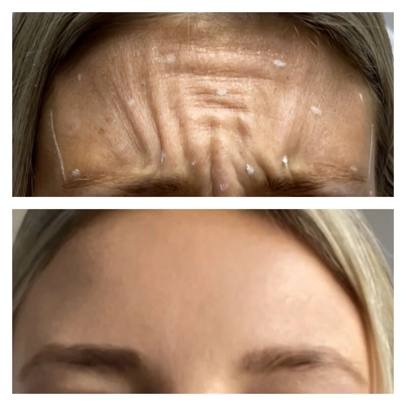 patient result 11