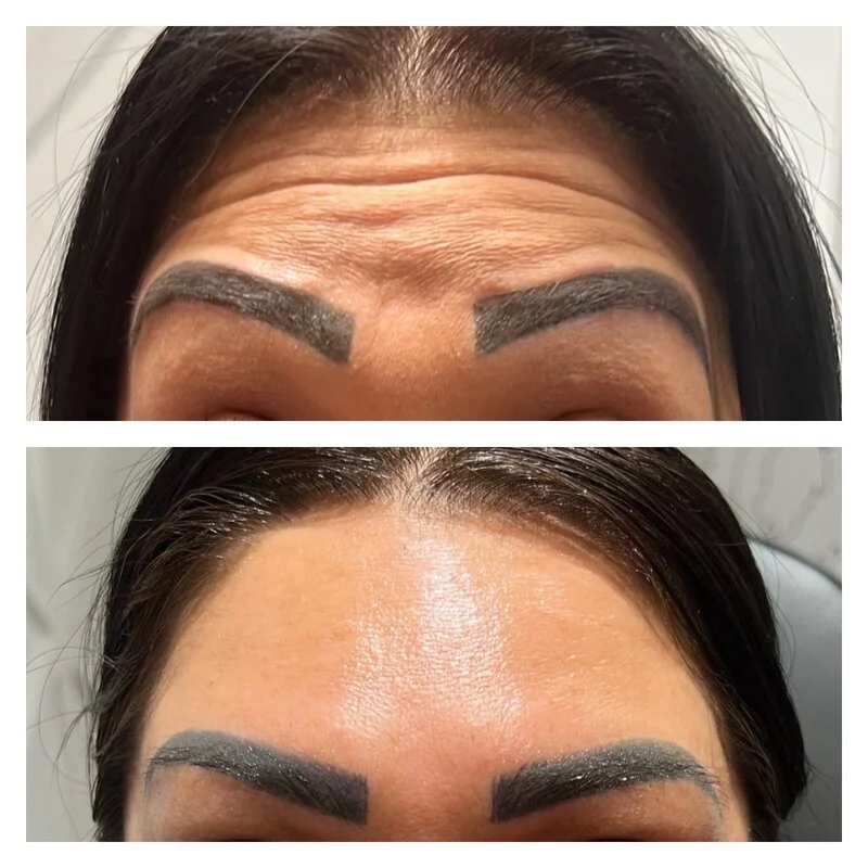 patient result 12