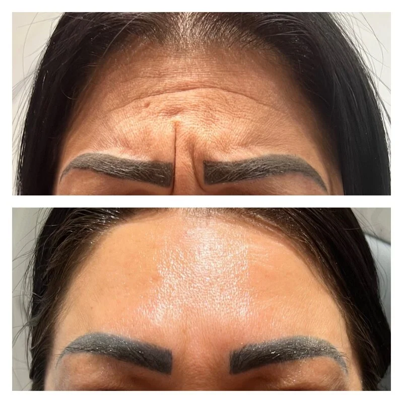 patient result 13