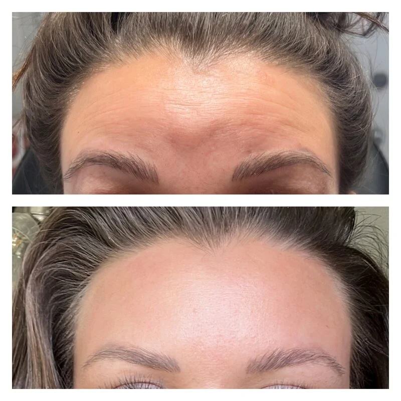 patient result 14