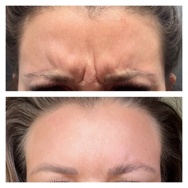patient result 15