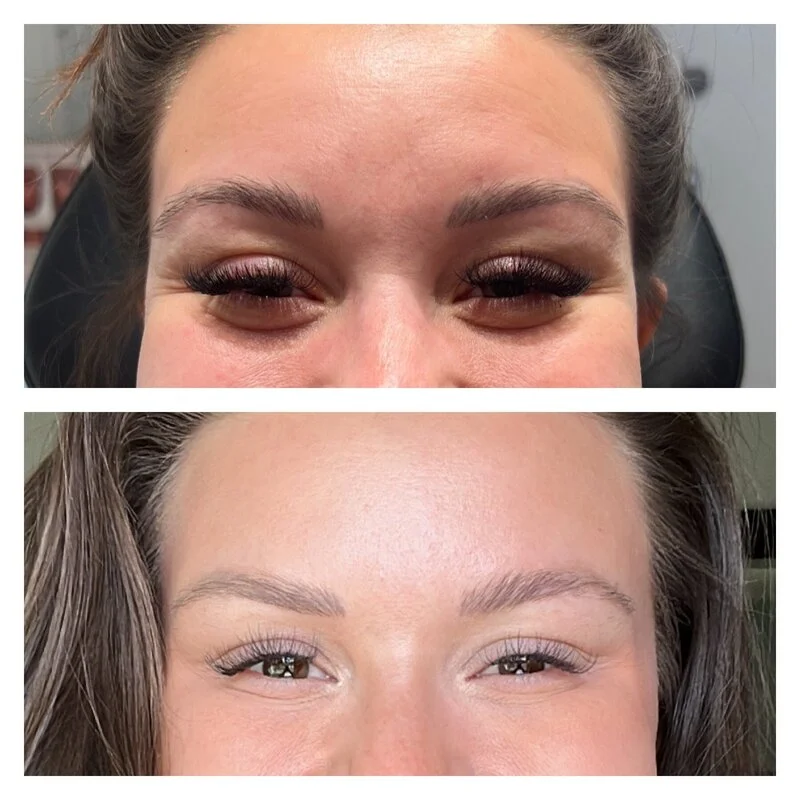 patient result 16