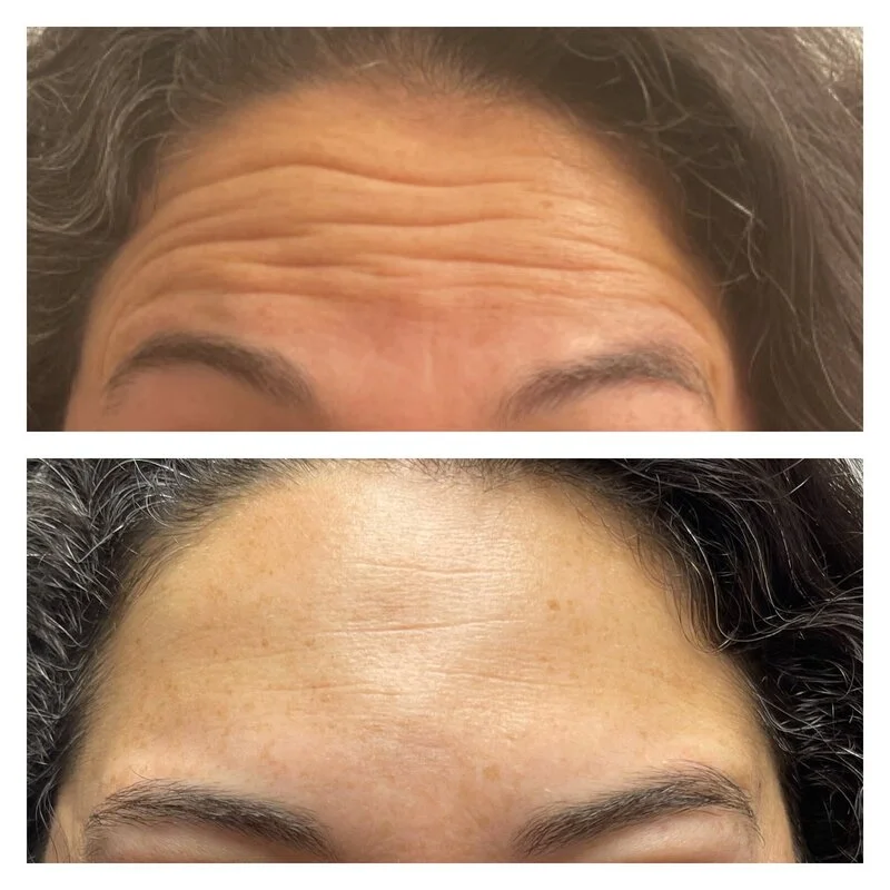 patient result 17