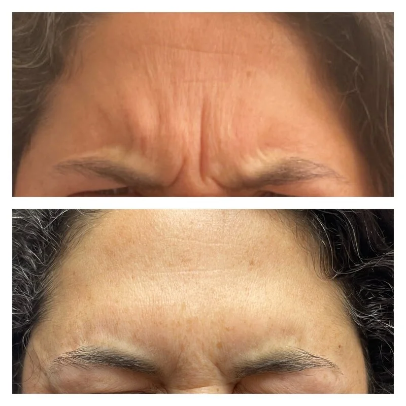 patient result 18