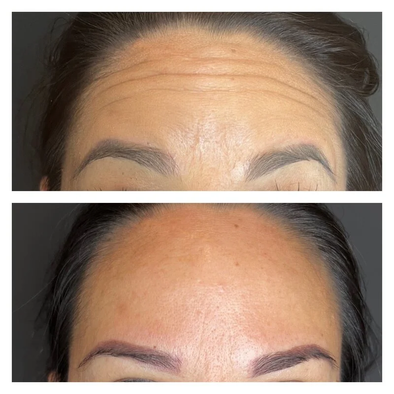 patient result 1