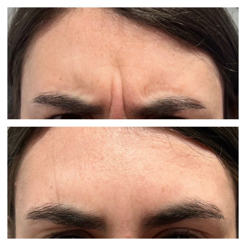 patient result 19