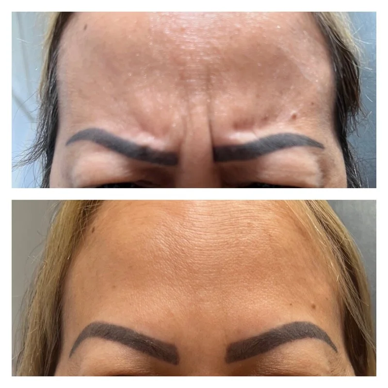 patient result 20