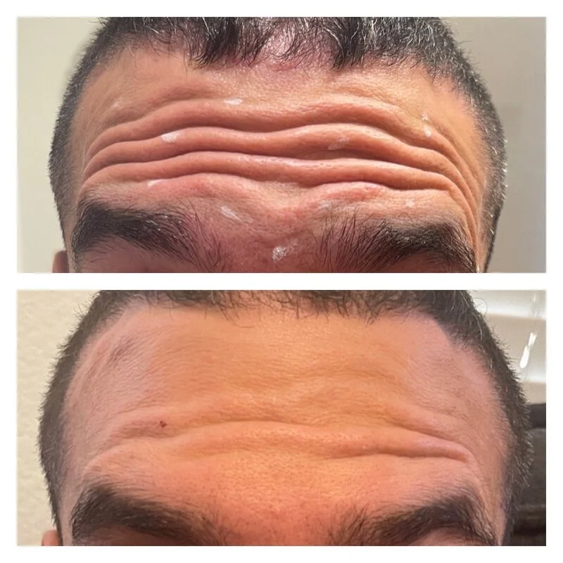 patient result 22