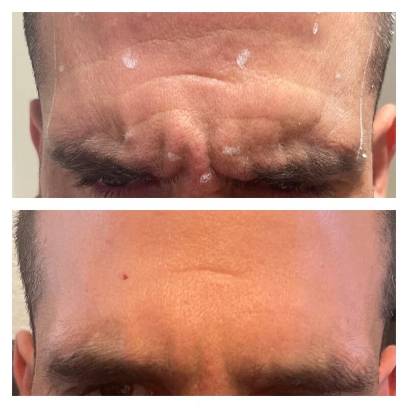 patient result 23