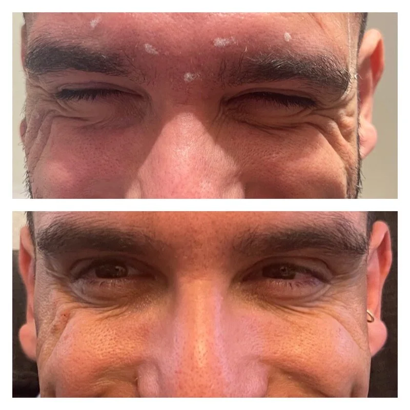 patient result 24
