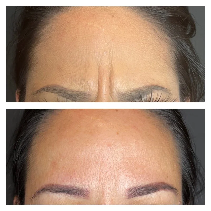 patient result 2
