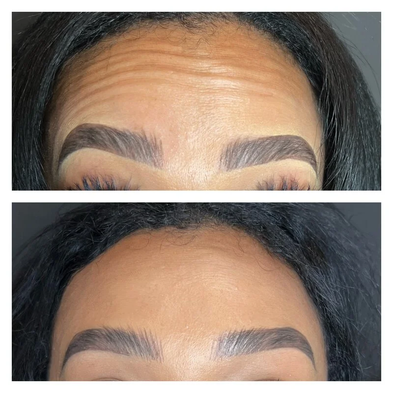 patient result 3