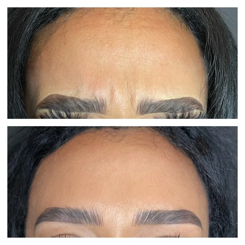 patient result 4