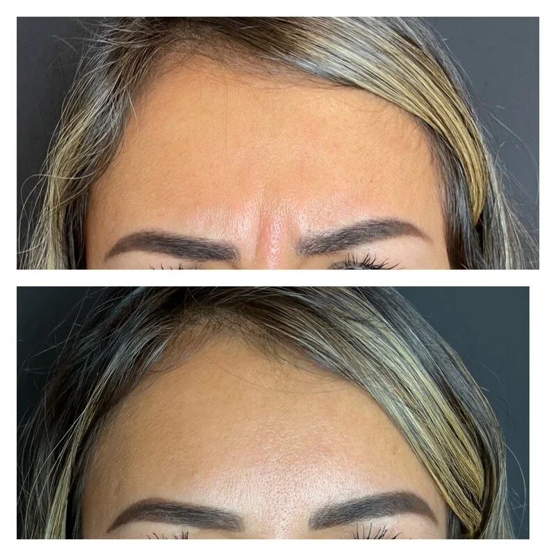 patient result 5