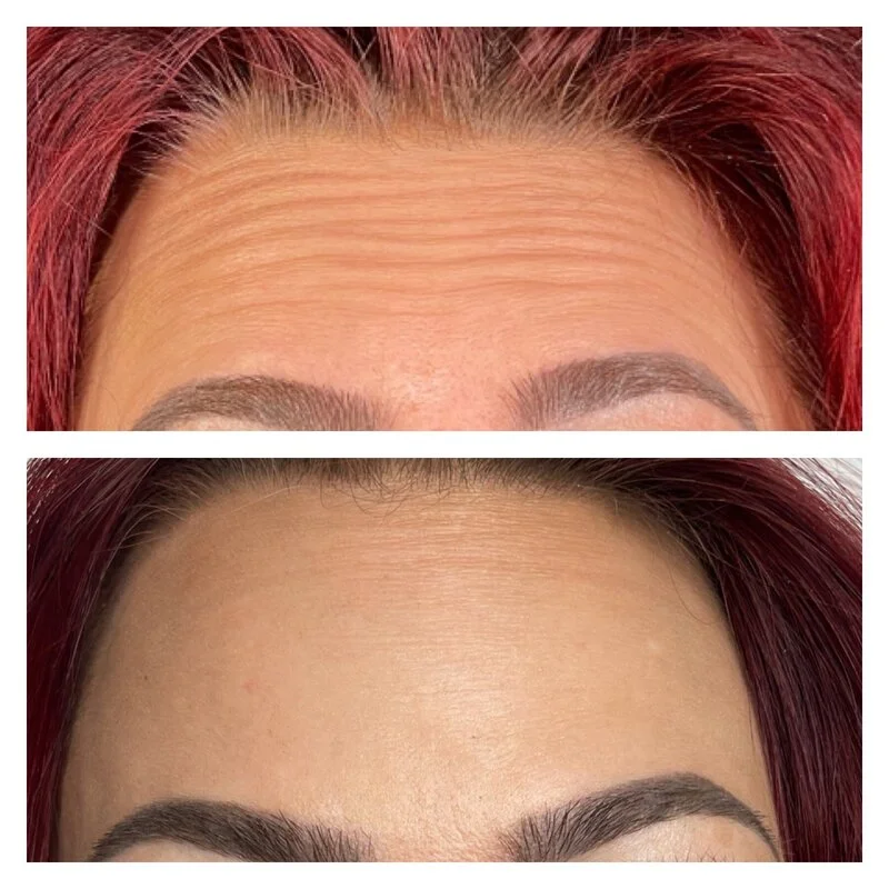 patient result 6