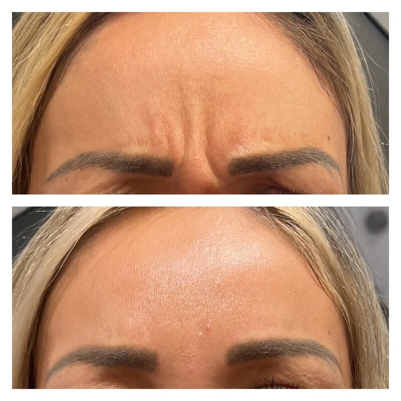 patient result 7