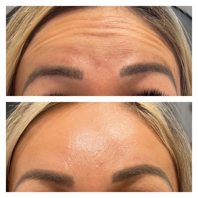 patient result 8
