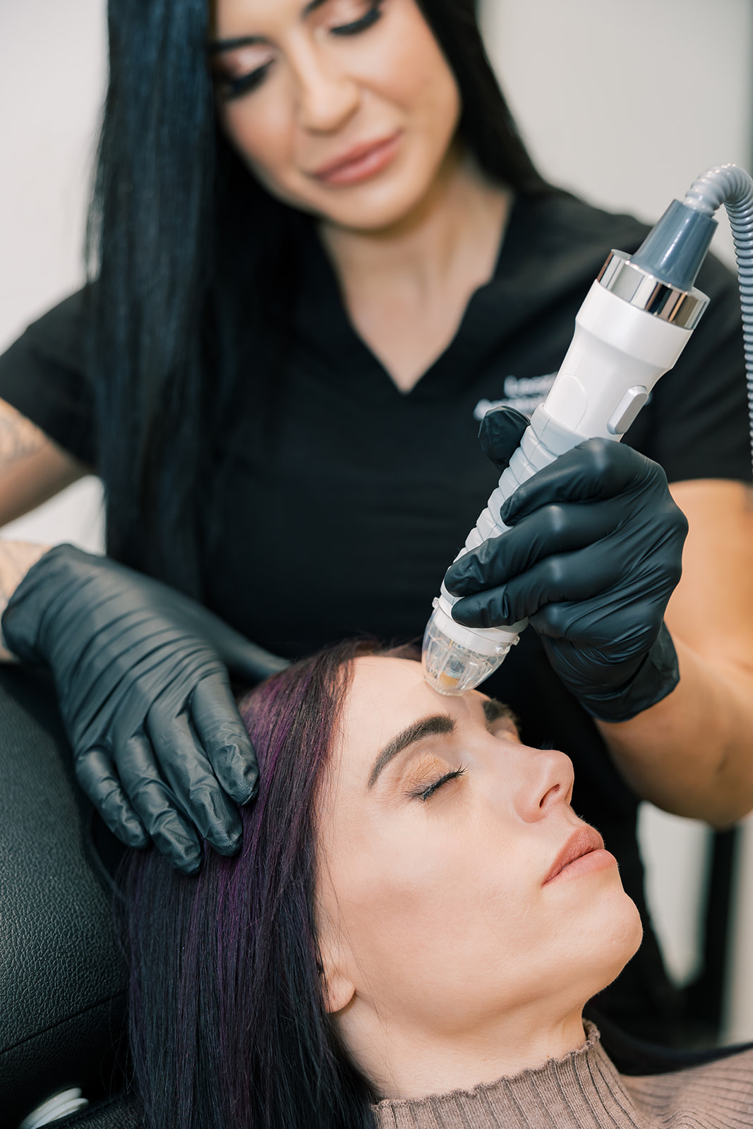 RF Microneedling